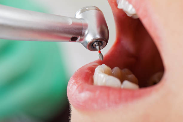 Best Emergency Root Canal Therapy in Randolph Af, TX